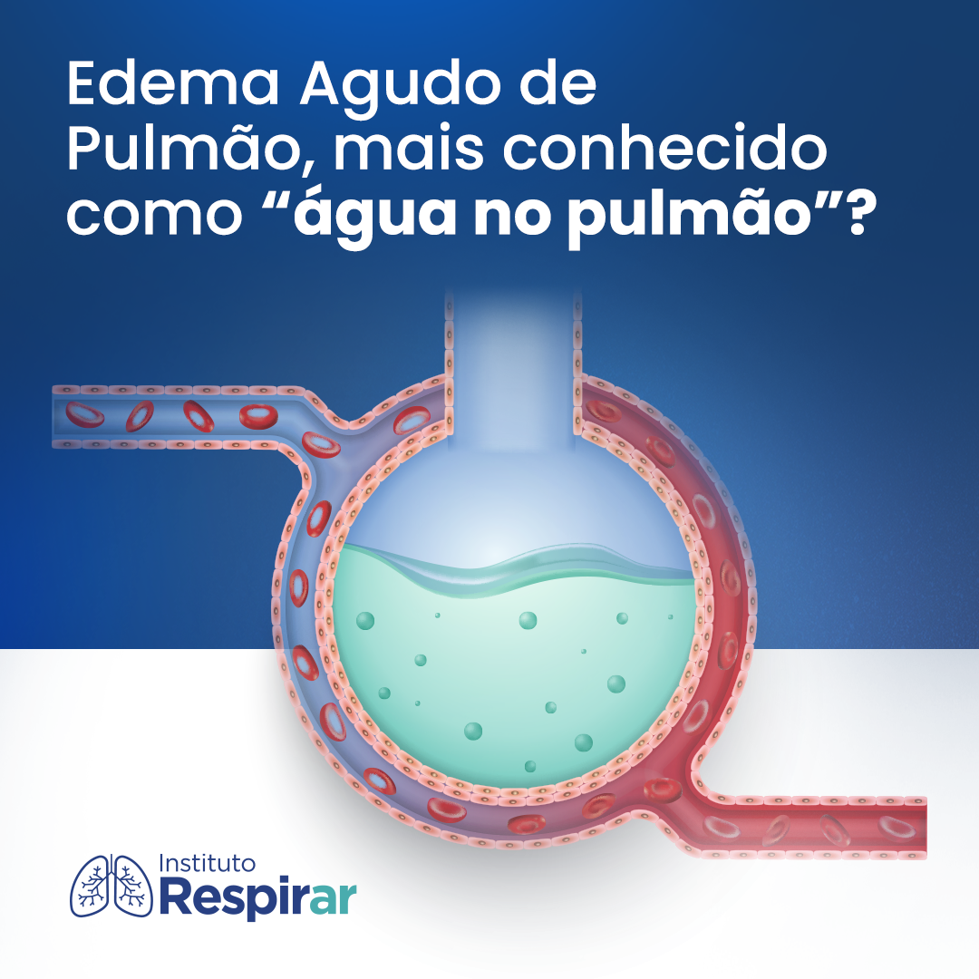 tratamento para água no pulmão