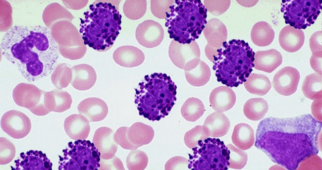 basopenia significado