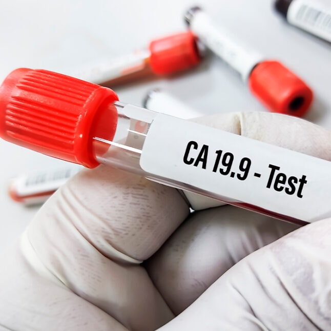 ca19-9 o que significa
