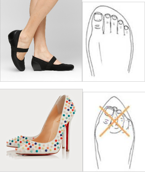 erros ao escolher sapato para pé diabético