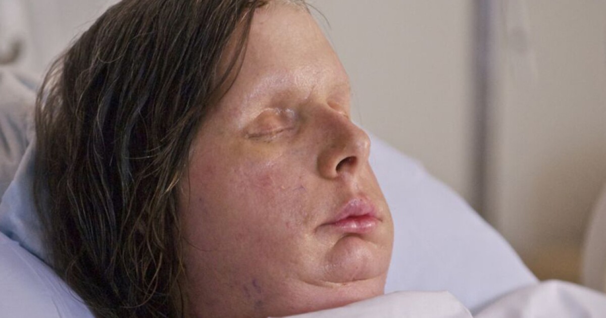 O Caso Travis: Como o Ataque do Chimpanzé Mudou a Legislação sobre Animais Selvagens