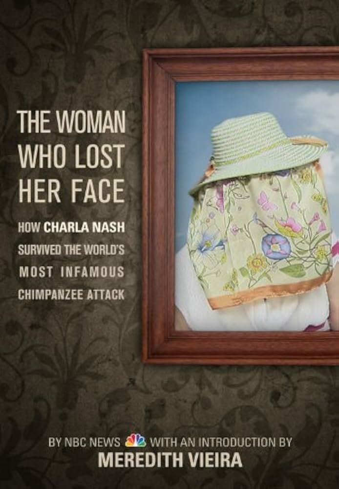 A História Completa de Charla Nash: O Ataque do Chimpanzé Travis e Sua Luta Pela Vida