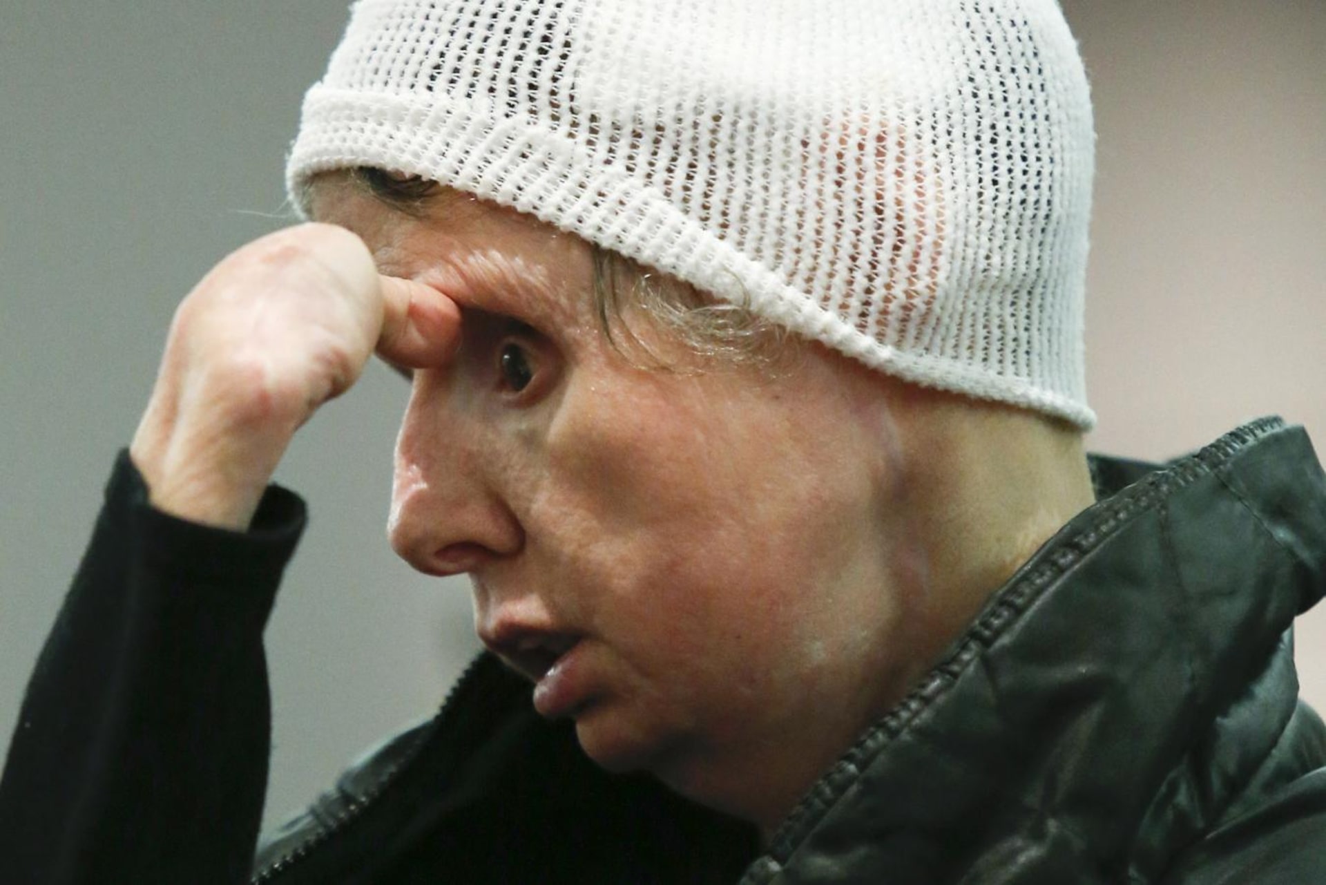 Charla Nash Hoje: Vida Após o Ataque e o Ativismo Contra a Posse de Primatas