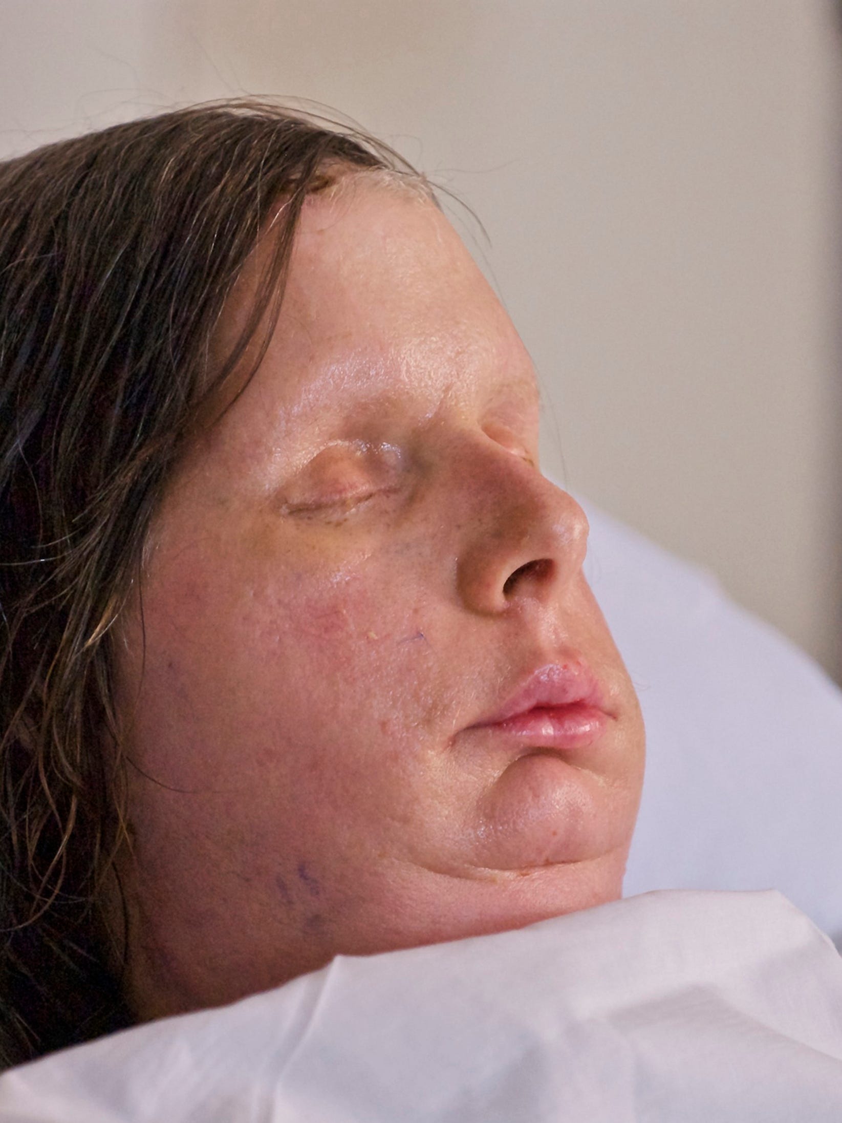 A História Completa de Charla Nash: O Ataque do Chimpanzé Travis e Sua Luta Pela Vida