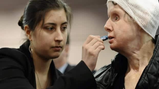 O Caso Travis: Como o Ataque do Chimpanzé Mudou a Legislação sobre Animais Selvagens