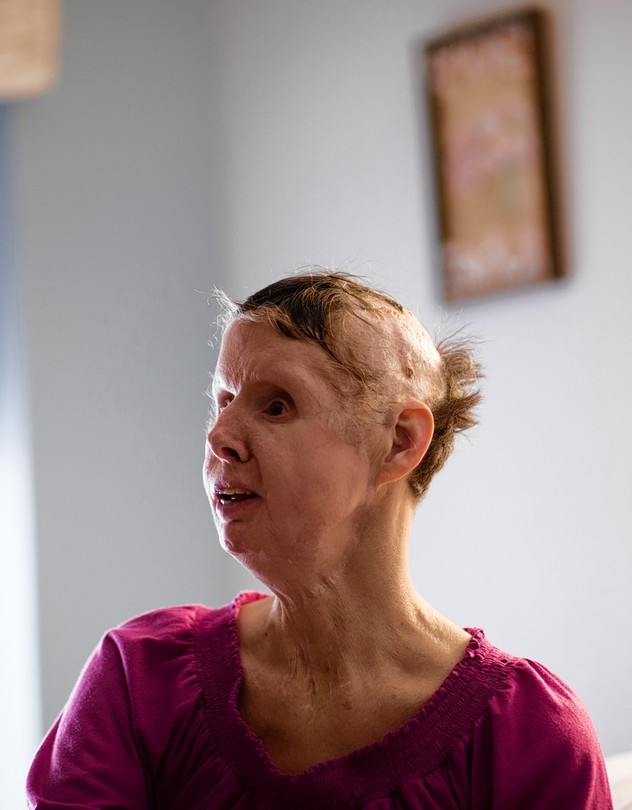 O Caso Travis: Como o Ataque do Chimpanzé Mudou a Legislação sobre Animais Selvagens