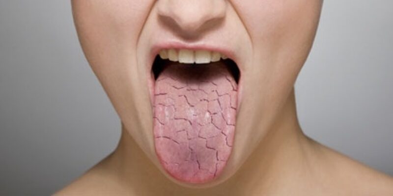 o que significa cid m35.0