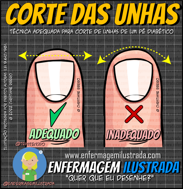como cortar unhas de diabéticos corretamente
