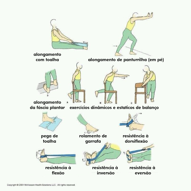 erros comuns alongar fascia plantar dor