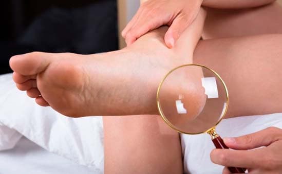 10 dicas essenciais para cuidar dos pés com diabetes