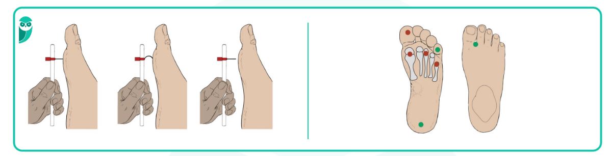 como testar temperatura agua pe diabetico