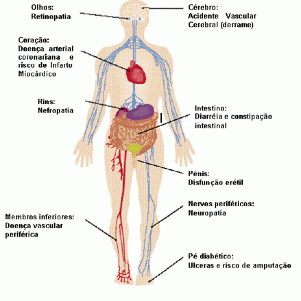 sintomas diabetes