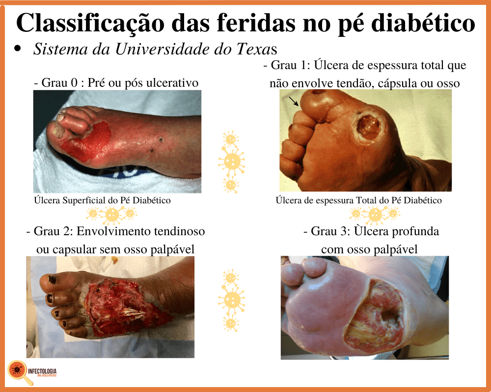 custo tratamento complicacoes pe diabetico
