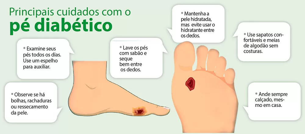 como evitar amputação pé diabético 7 dicas