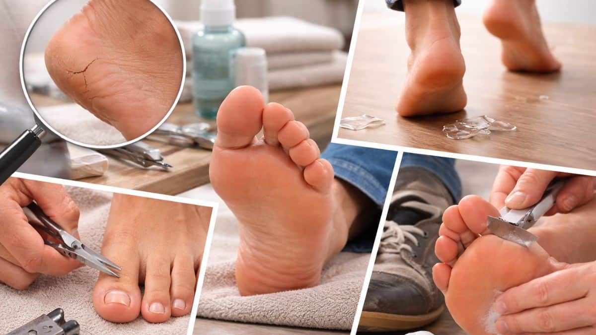 erros comuns cuidado pés neuropatia diabética