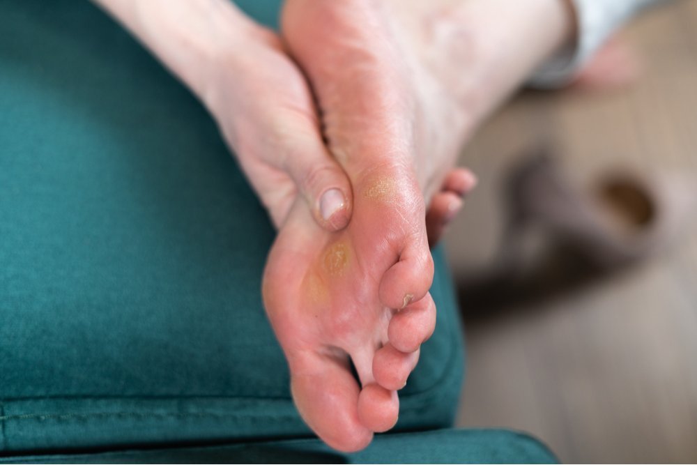 7 hábitos essenciais para proteger seus pés com neuropatia diabética