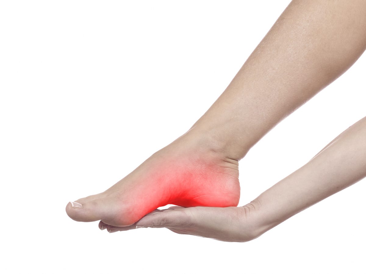 escalda pes piora fascite plantar cronica o que fazer