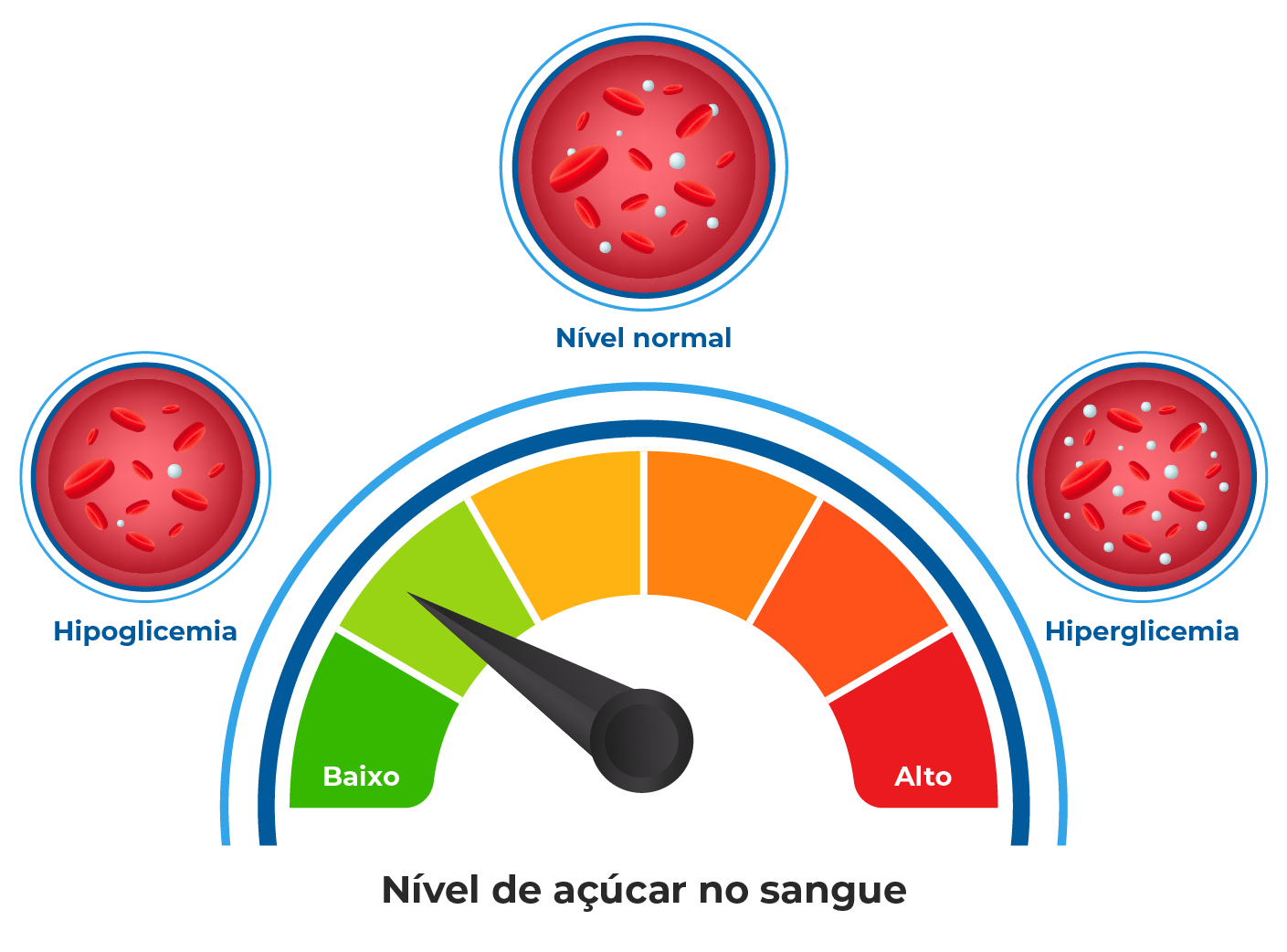 glicose baixa e diabetes tipo 2