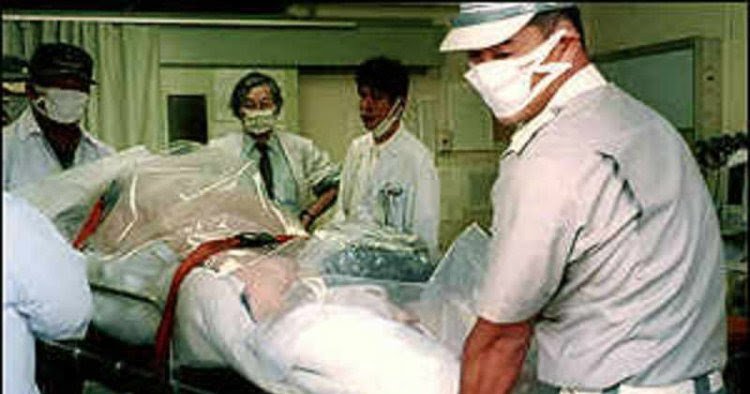 Desvendando a Verdade: As Fotos Reais de Hisashi Ouchi; Tokaimura: Entenda o Acidente Nuclear que Marcou a História; Os Efeitos da Radiação no Corpo Humano: O Caso Hisashi Ouchi; Além de Chernobyl: Outros Acidentes Nucleares Notáveis; A Ciência por Trás da Radiação: O que são Sieverts?; Documentários sobre Acidentes Nucleares: Onde Assistir 'A Slow Death'?