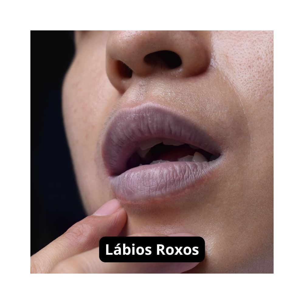 lábio roxo o que pode ser