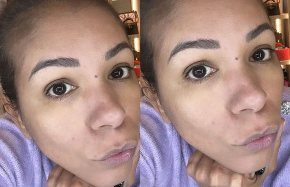 Problemas Respiratórios e Lábios Azulados: Um Sinal de Alerta?