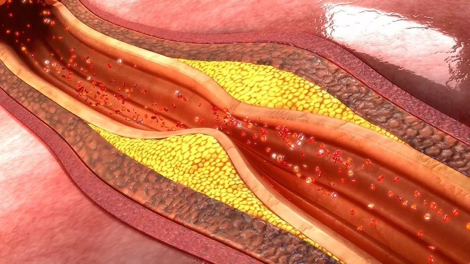 o que significa lipoproteína alta