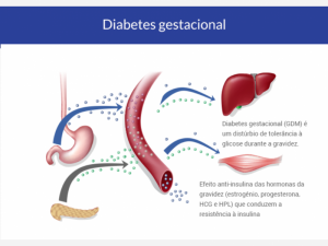 diabetes gestacional vs diabetes tipo 1 na gravidez