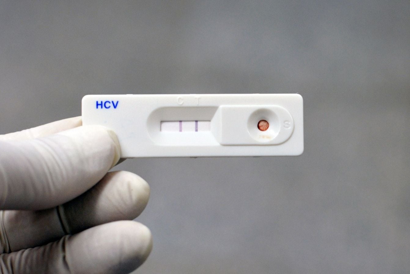 o que é o exame anti-hcv