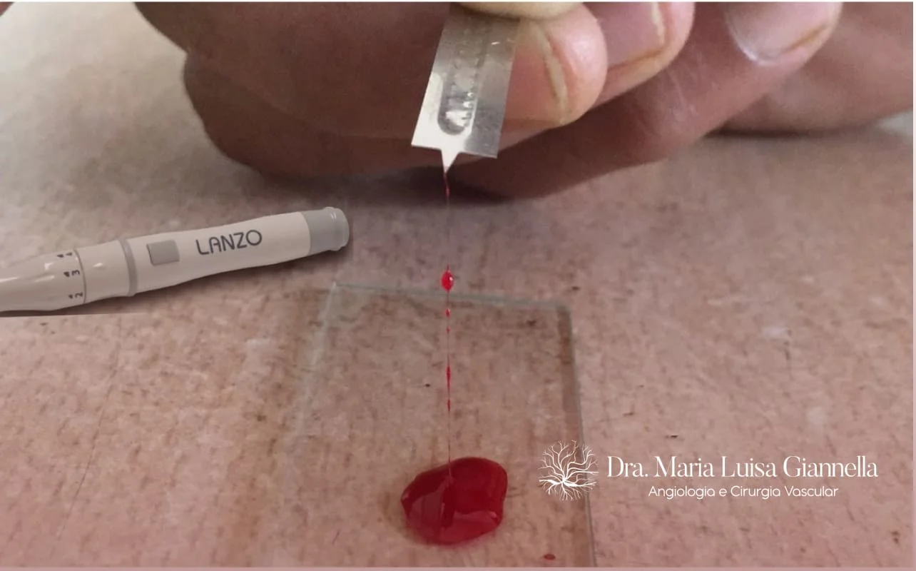 coagulograma completo