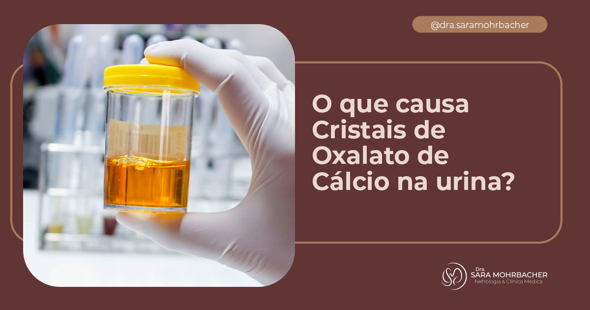 o que significa cristais de oxalato de cálcio na urina
