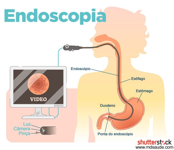 significado de EDA na saúde