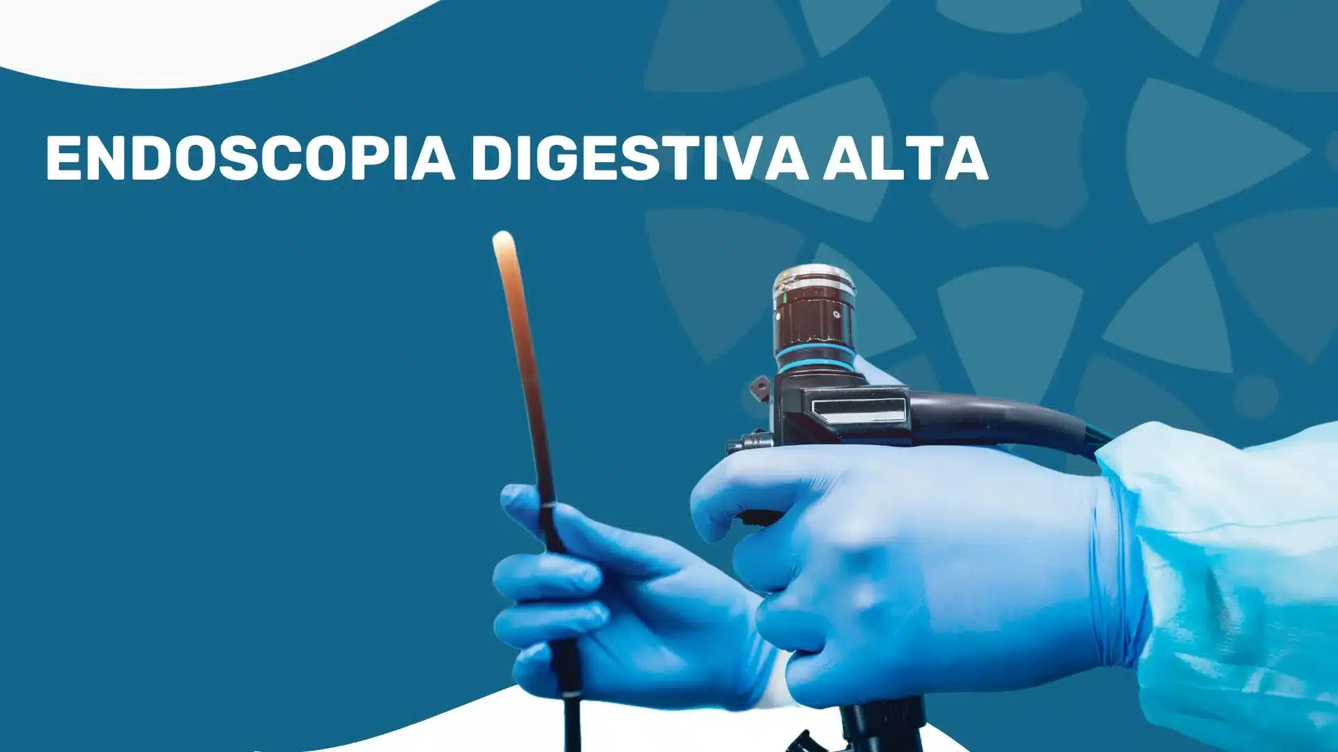 exame endoscopia digestiva alta