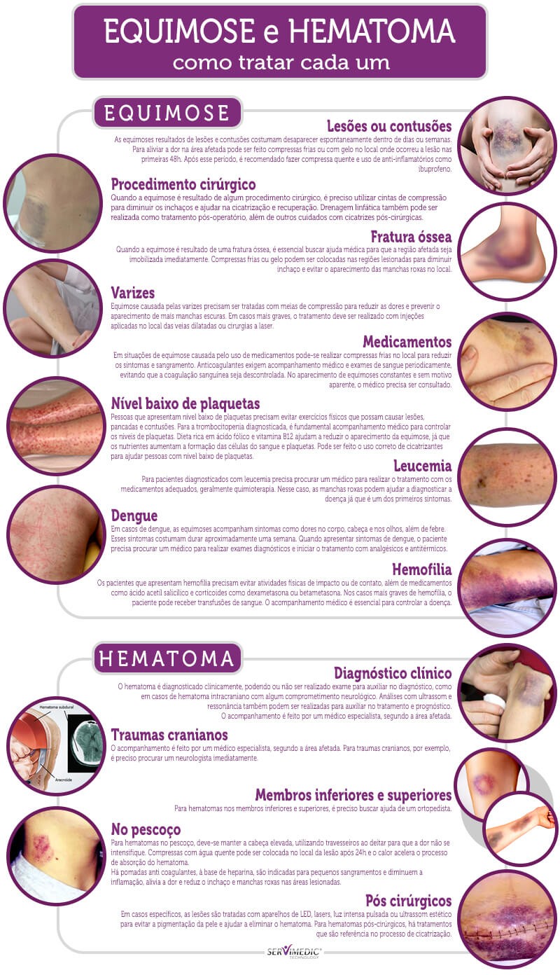 Diferença entre equimose e hematoma