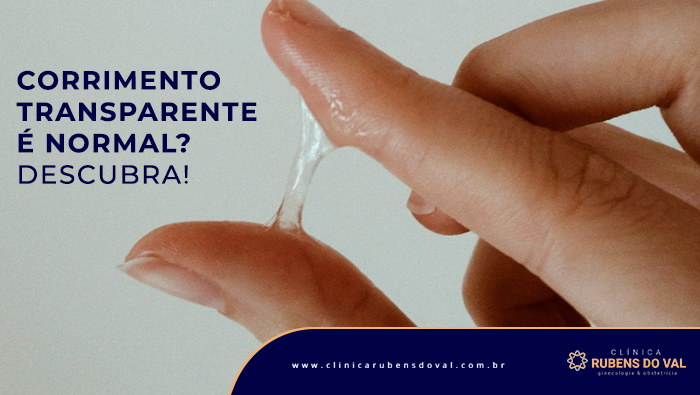 corrimento branco e coceira