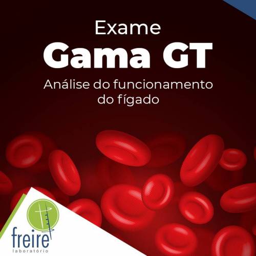 o que significa gama gt alto