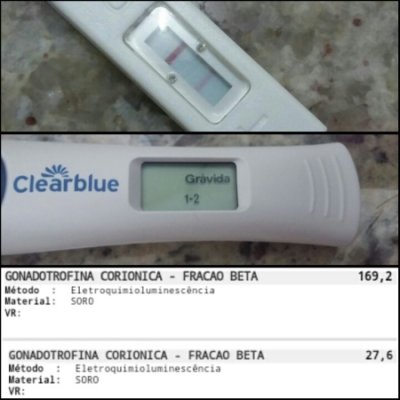 o que é gravidez bioquímica