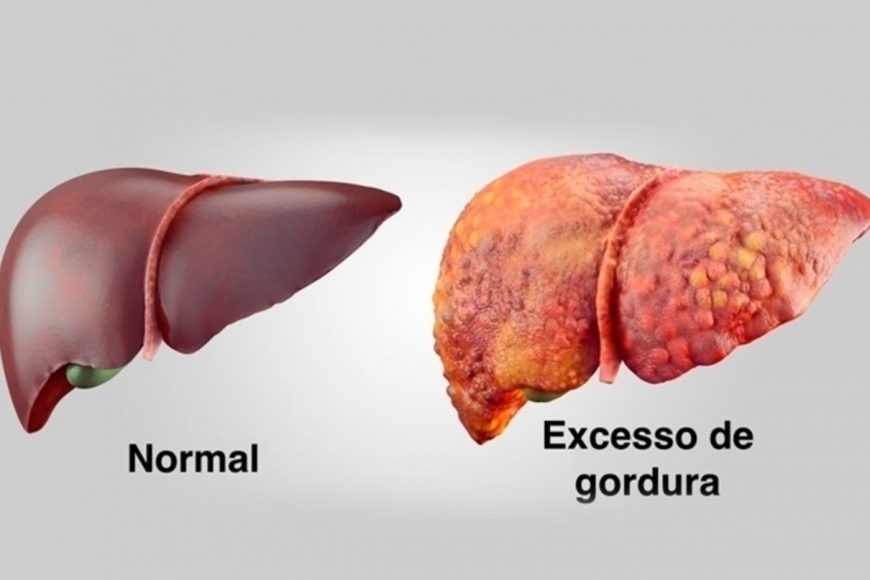 adjetivo hepático