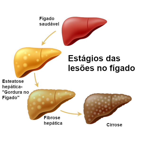 termo hepático significado