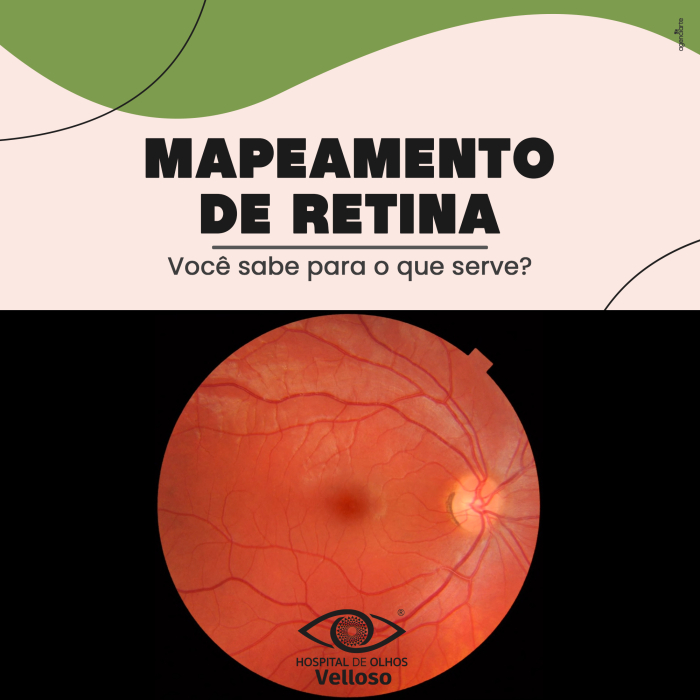 Como é feito o mapeamento de retina
