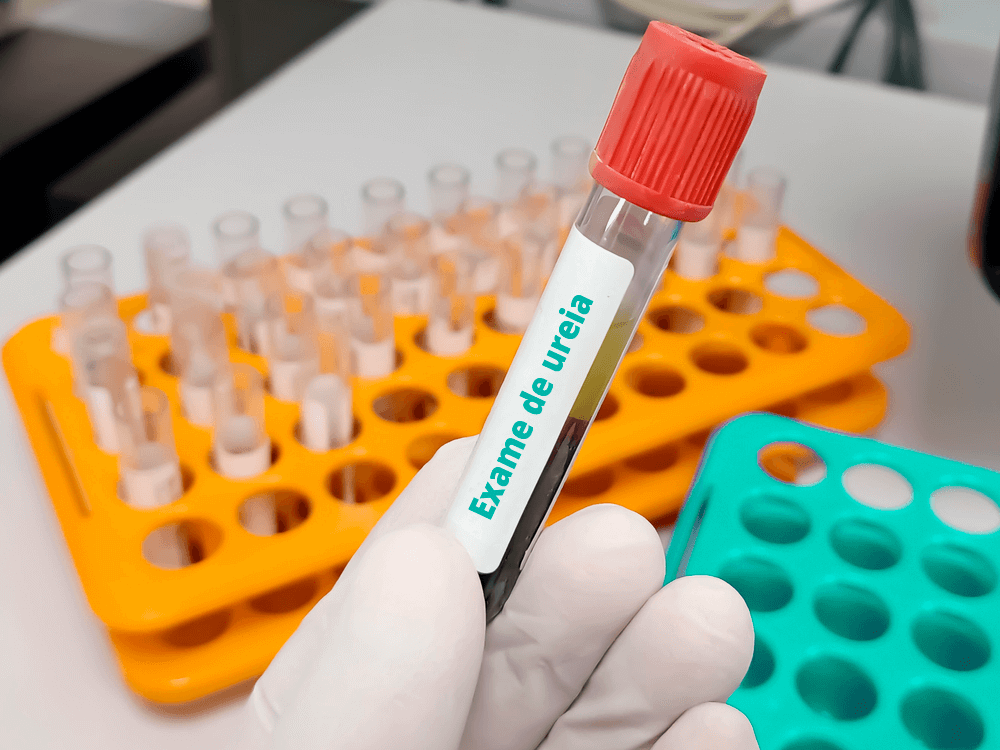 valores normais de ureia no sangue