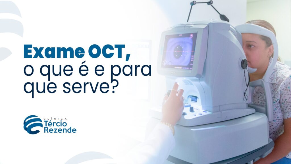 exame OCT para que serve