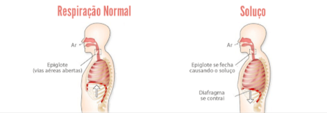 causas de soluço que não passa