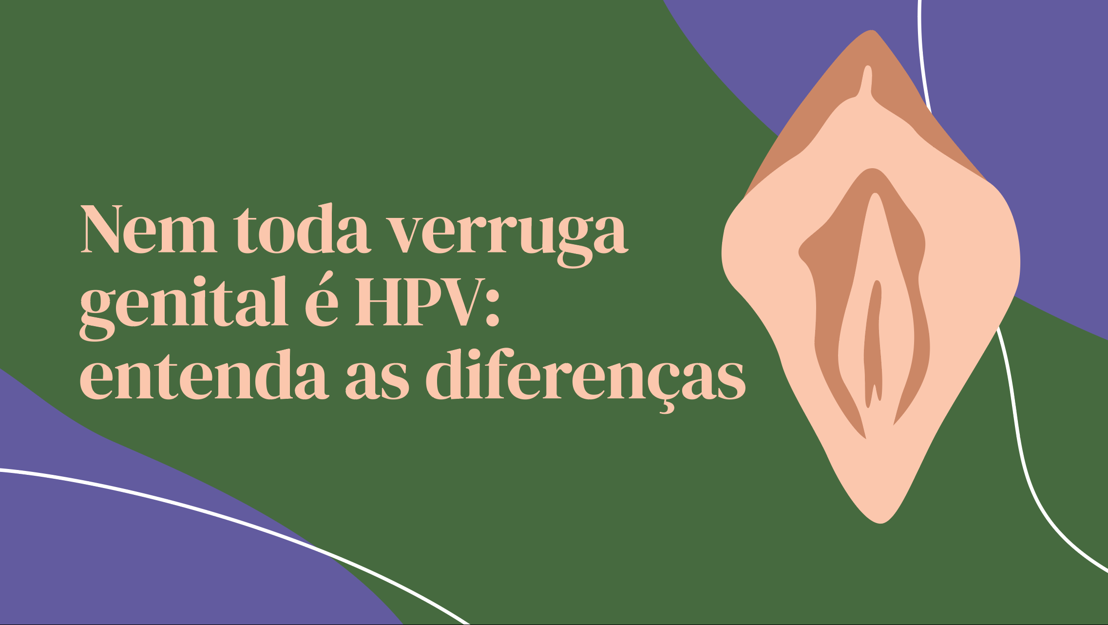 verruga genital causa HPV