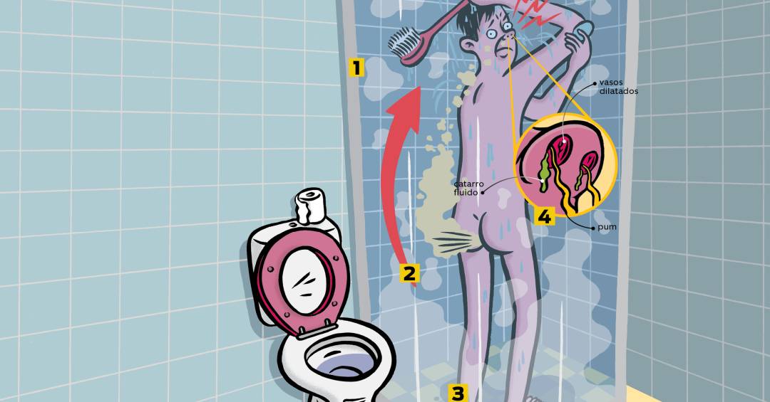 Desvendando o Mistério: Por Que Nossos Puns Têm Cheiro Forte?