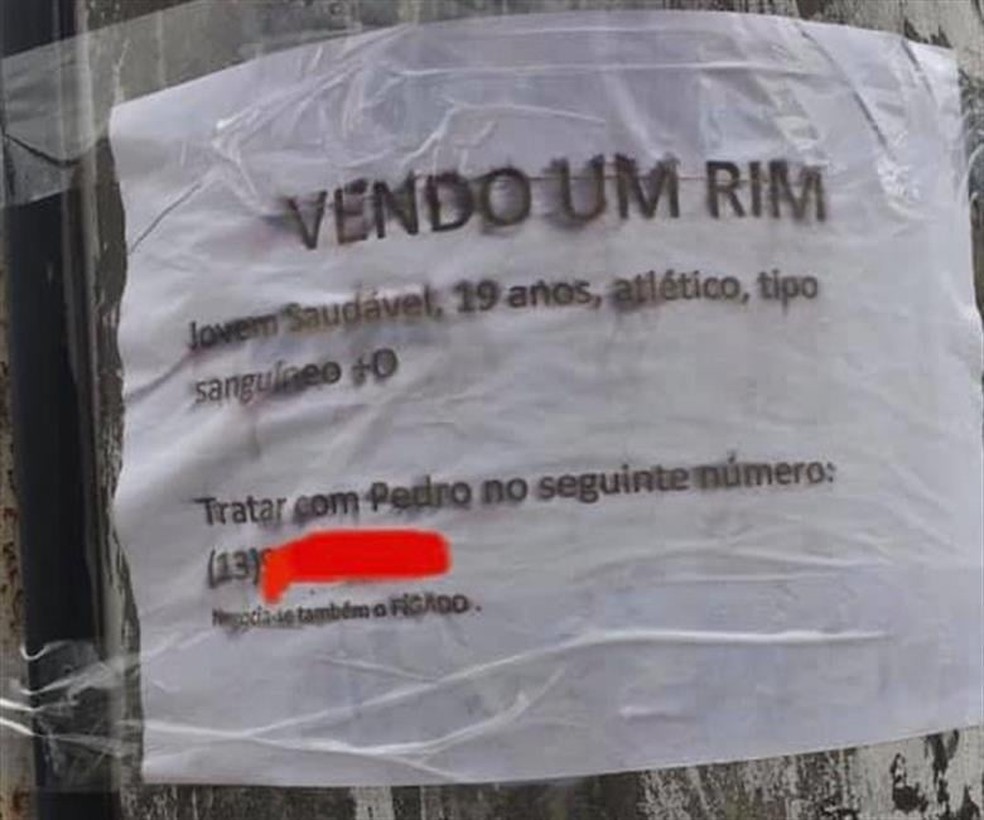 Vender um Rim é Crime? O Que Diz a Lei Brasileira sobre a Comercialização de Órgãos