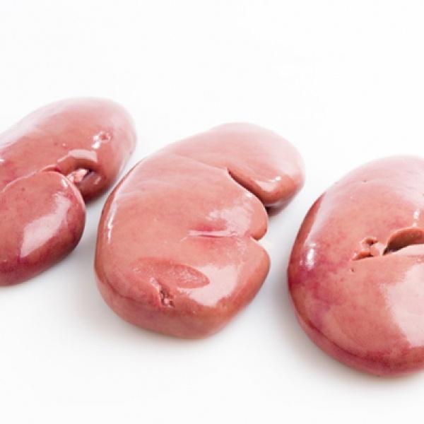 Hemodiálise vs. Transplante: Comparativo de Custos e Qualidade de Vida