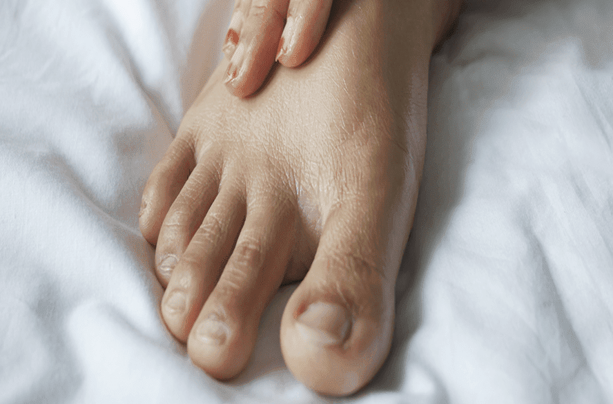 quanto custa nao cuidar do pe diabetico