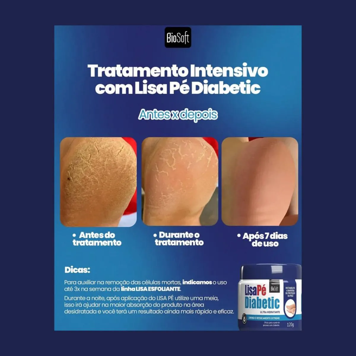 10 passos essenciais para cuidar do pé diabético e economizar