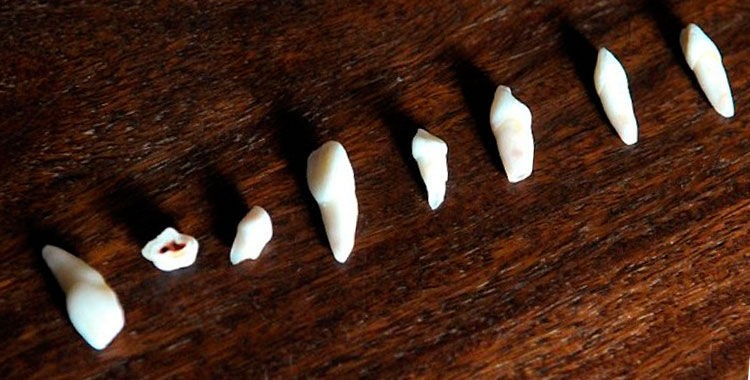 sonhar com dente podre