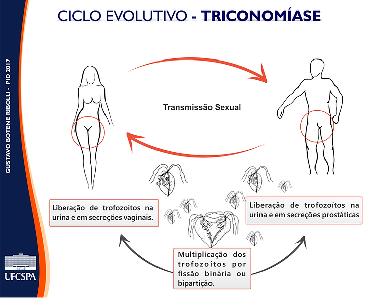 Complicações da Tricomoníase Não Tratada em Homens: Entenda os Riscos